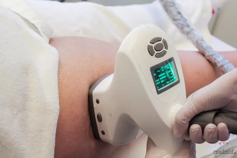 zabieg-modente-w-vivien-clinic-w-krakowie-11