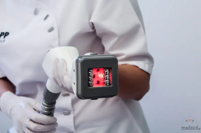 zabieg-modente-w-vivien-clinic-w-krakowie-14