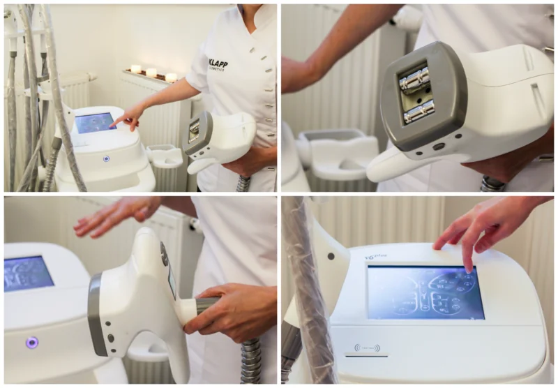 zabieg-modente-w-vivien-clinic-w-krakowie-kolaz