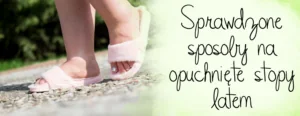 sprawdzone sposoby na opuchniete stopy latem